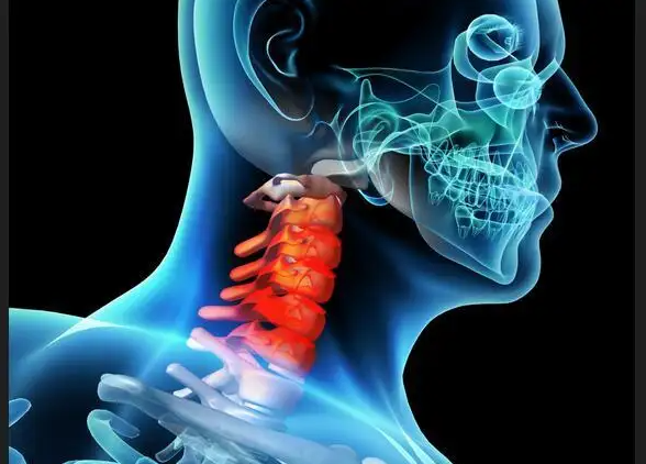 怎樣分辨頸椎病高血壓？王濤博士給與解答！